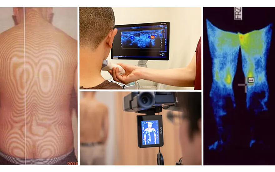 医療用サーモグラフィ、モアレトポグラフィ、循環器用エコー