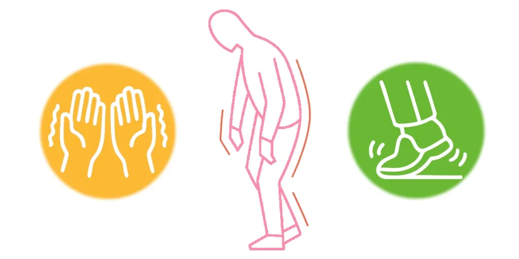 SCA3はパーキンソン病のような症状が出ることがある