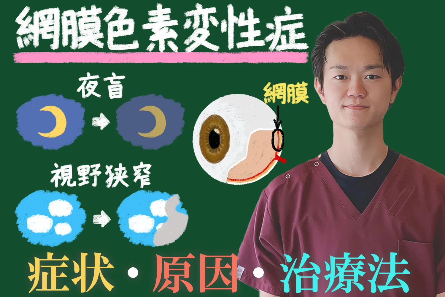 網膜色素変性症とはどのような症状か｜原因や治療法まで詳しく解説！