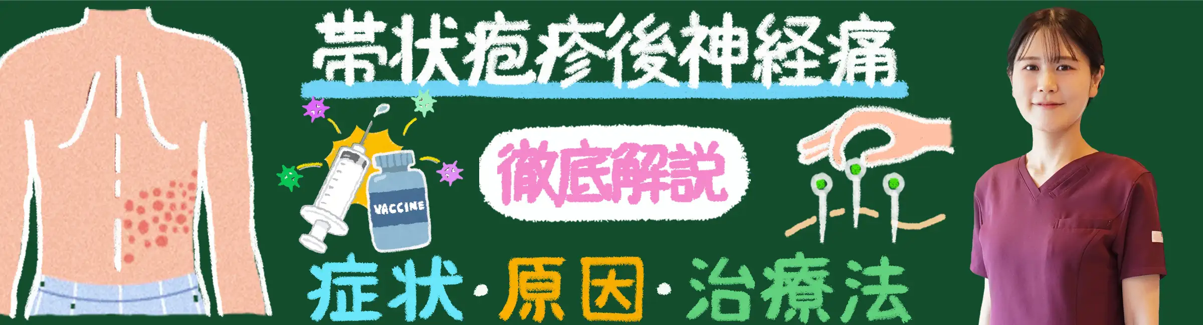 「帯状疱疹後神経痛とは？症状・原因・治療法を徹底解説！」