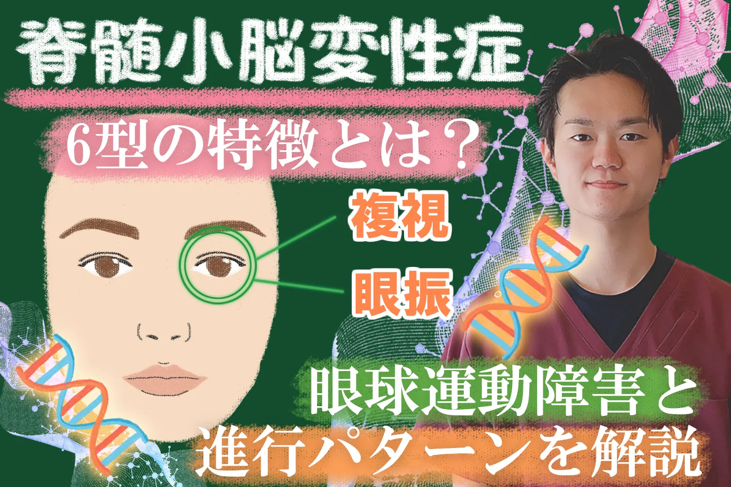 脊髄小脳変性症6型の特有症状は？初期から見られる眼球運動障害などについて詳しく解説