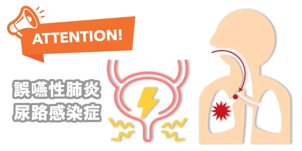 脊髄小脳変性症は身体機能低下による合併症に要注意